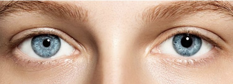 Uma pupila maior que a outra: entenda a anisocoria